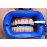 Afastador e Abridor Boca Maquira