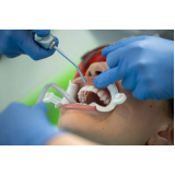 Afastador Labial Morelli