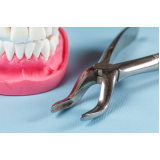 alicate ortodôntico preço Socorro alicate ortodôntico preço Socorro