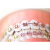 Arcos Niti Orthometric