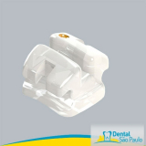 braquete de porcelana Vila Batista braquete de porcelana Vila Batista