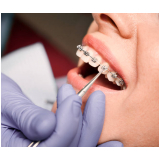 dental orto Jockey Clube dental orto Jockey Clube