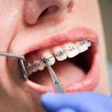 dental ortodontia de produtos morelli preço Taboão da Serra dental ortodontia de produtos morelli preço Taboão da Serra