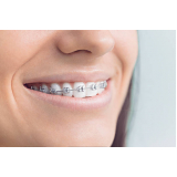 dental ortodontia de produtos morelli Caierias dental ortodontia de produtos morelli Caierias