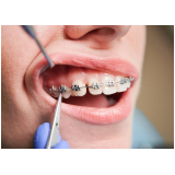 dental ortodontia produtos orthomertric preço Centro dental ortodontia produtos orthomertric preço Centro