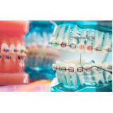 Kit Ferramentas Mini Parafusos Ortodônticos