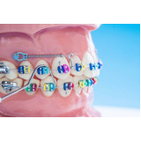 Mini Parafuso Morelli