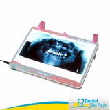 negatoscópio odontológico led de mesa Parque Peruche negatoscópio odontológico led de mesa Parque Peruche