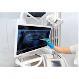 negatoscopio odontológico slim led branco barato Paulínia negatoscopio odontológico slim led branco barato Paulínia