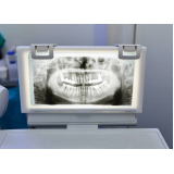 negatoscopio odontológico slim led branco valor Ibirapuera negatoscopio odontológico slim led branco valor Ibirapuera