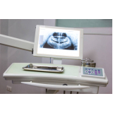 negatoscopio odontológico slim led essence Rio Claro negatoscopio odontológico slim led essence Rio Claro