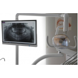 negatoscopio odontológico slim led rosa São Miguel Paulista negatoscopio odontológico slim led rosa São Miguel Paulista