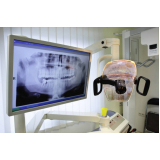 negatoscopio odontológico Penha negatoscopio odontológico Penha