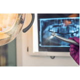 negatoscopio slim odontológico barato Vila Carrão negatoscopio slim odontológico barato Vila Carrão