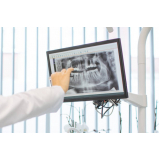 negatoscopio slim odontológico valor Juquitiba negatoscopio slim odontológico valor Juquitiba
