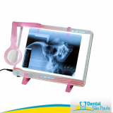 Negatoscópio Odontológico Portátil Negatoscópio Odontológico Portátil
