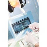 onde comprar negatoscopio endo panoramico essence Marapoama onde comprar negatoscopio endo panoramico essence Marapoama