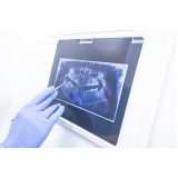 onde comprar negatoscopio odontológico slim led essence Ilha Comprida onde comprar negatoscopio odontológico slim led essence Ilha Comprida