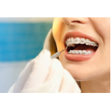 onde encontrar dental ortodontia de produtos morelli Embu Guaçú onde encontrar dental ortodontia de produtos morelli Embu Guaçú