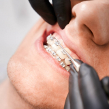 onde encontro dental orto Murundu onde encontro dental orto Murundu
