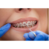 onde encontro dental ortodoncia Cajamar onde encontro dental ortodoncia Cajamar
