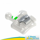 onde vende braquete de porcelana Vila Batista onde vende braquete de porcelana Vila Batista