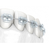 procuro braquetes morelli Rio Claro