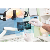 quanto custa negatoscopio endo panoramico essence Jardim São Paulo quanto custa negatoscopio endo panoramico essence Jardim São Paulo